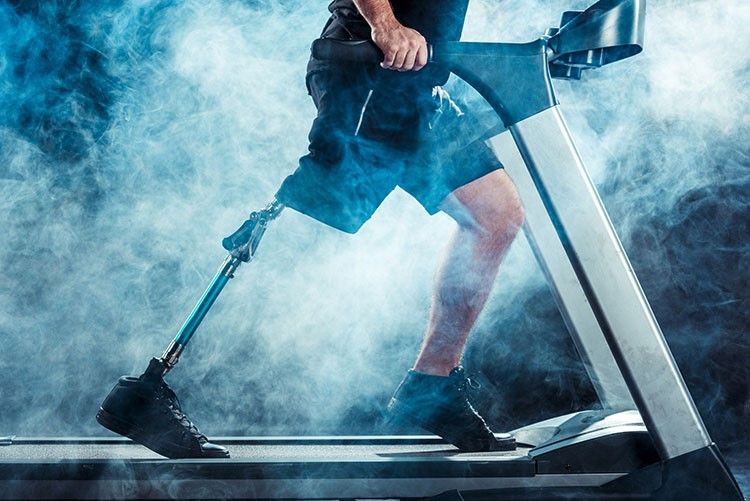 Beneficios de las prótesis de piernas y los cuidados que se necesitan, según miprotesisdepierna.mx