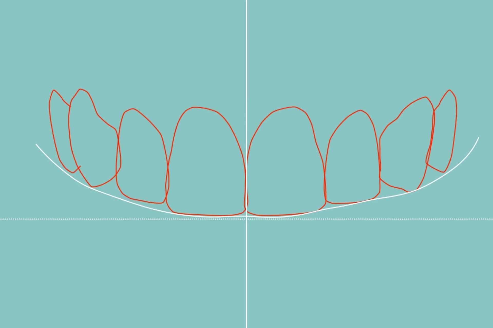 Clínica Dental Blay + Monzó dispone de tecnología de vanguardia para el diseño de sonrisa