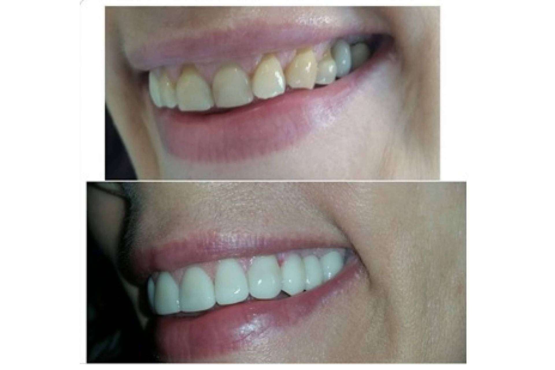 ¿Por qué la halitosis puede ser una causa de divorcio?