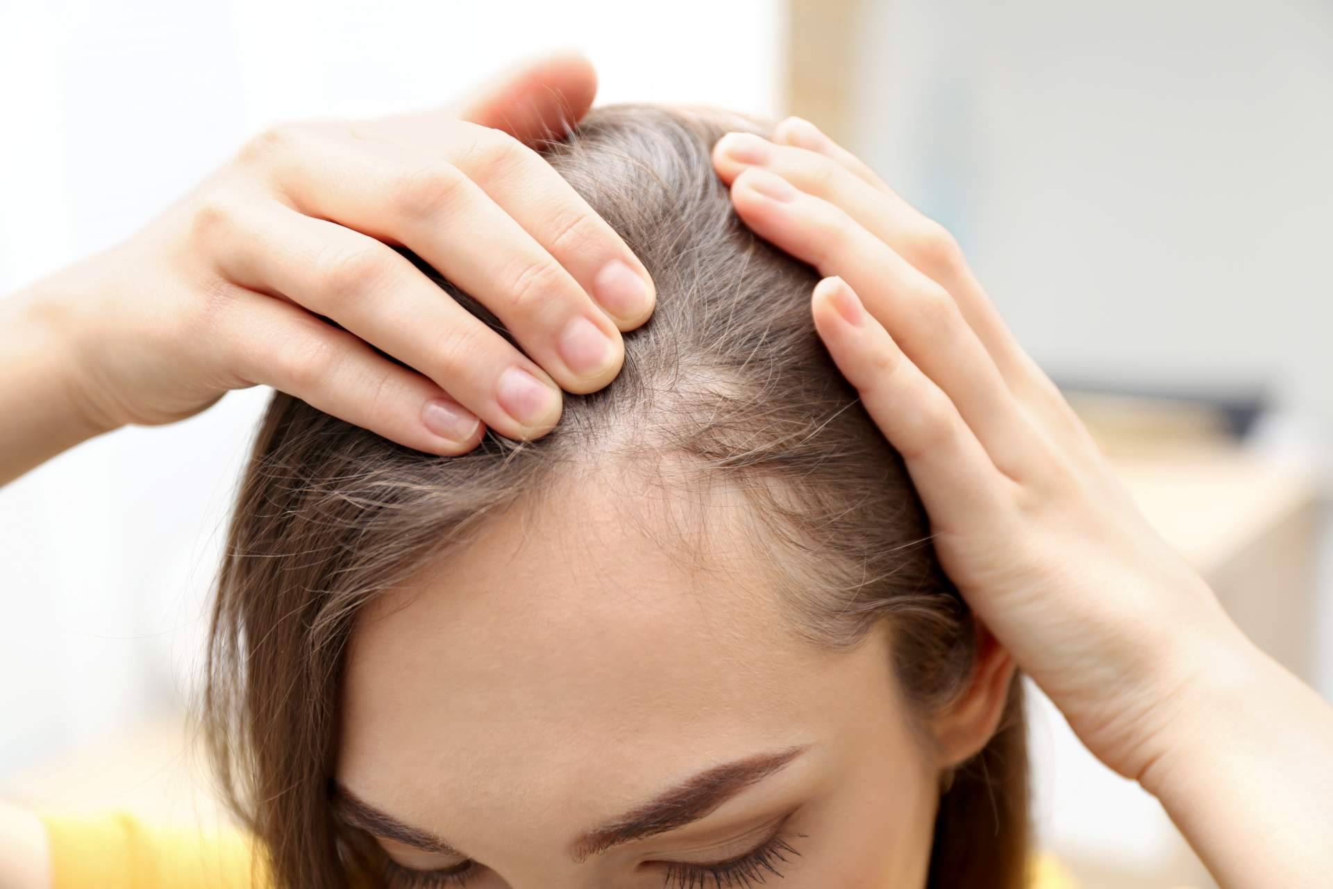 Élite Capilar combate la alopecia con injertos capilares efectivos