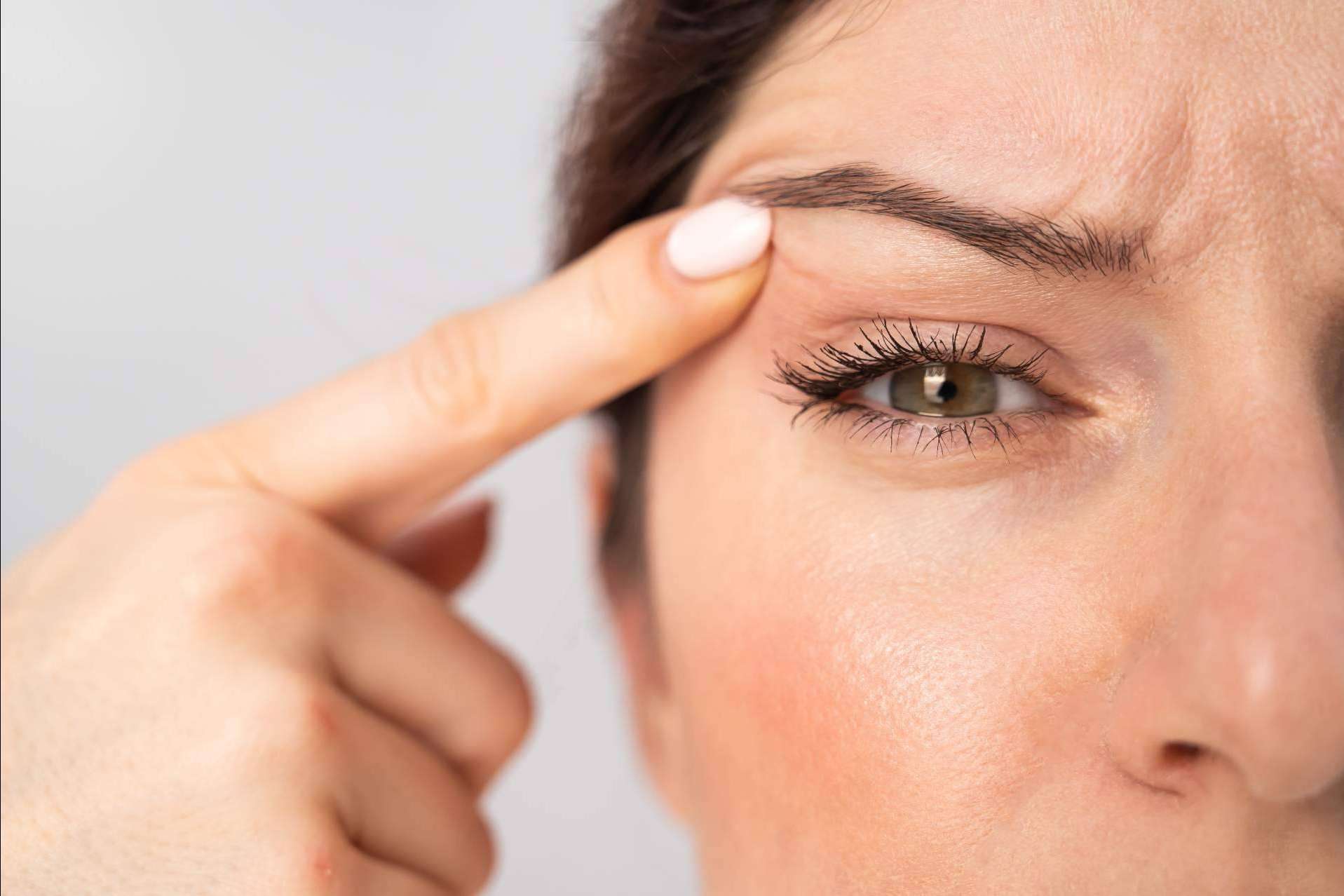 La blefaroplastia sin cirugía llega de la mano del plasma láser de Alluring Clinic