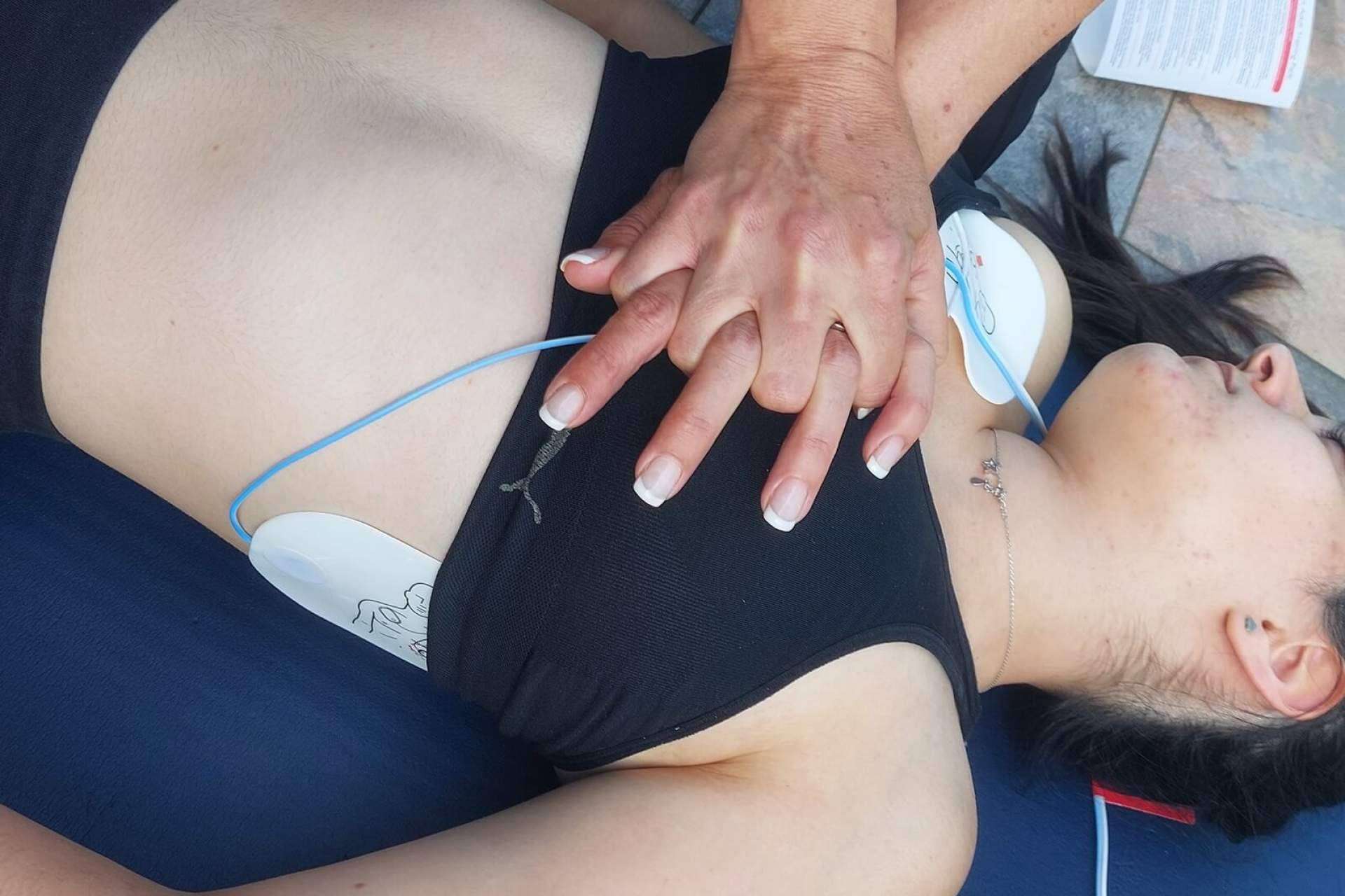 Soporte vital ante una emergencia, qué es y cómo aplicarlo para salvar vidas