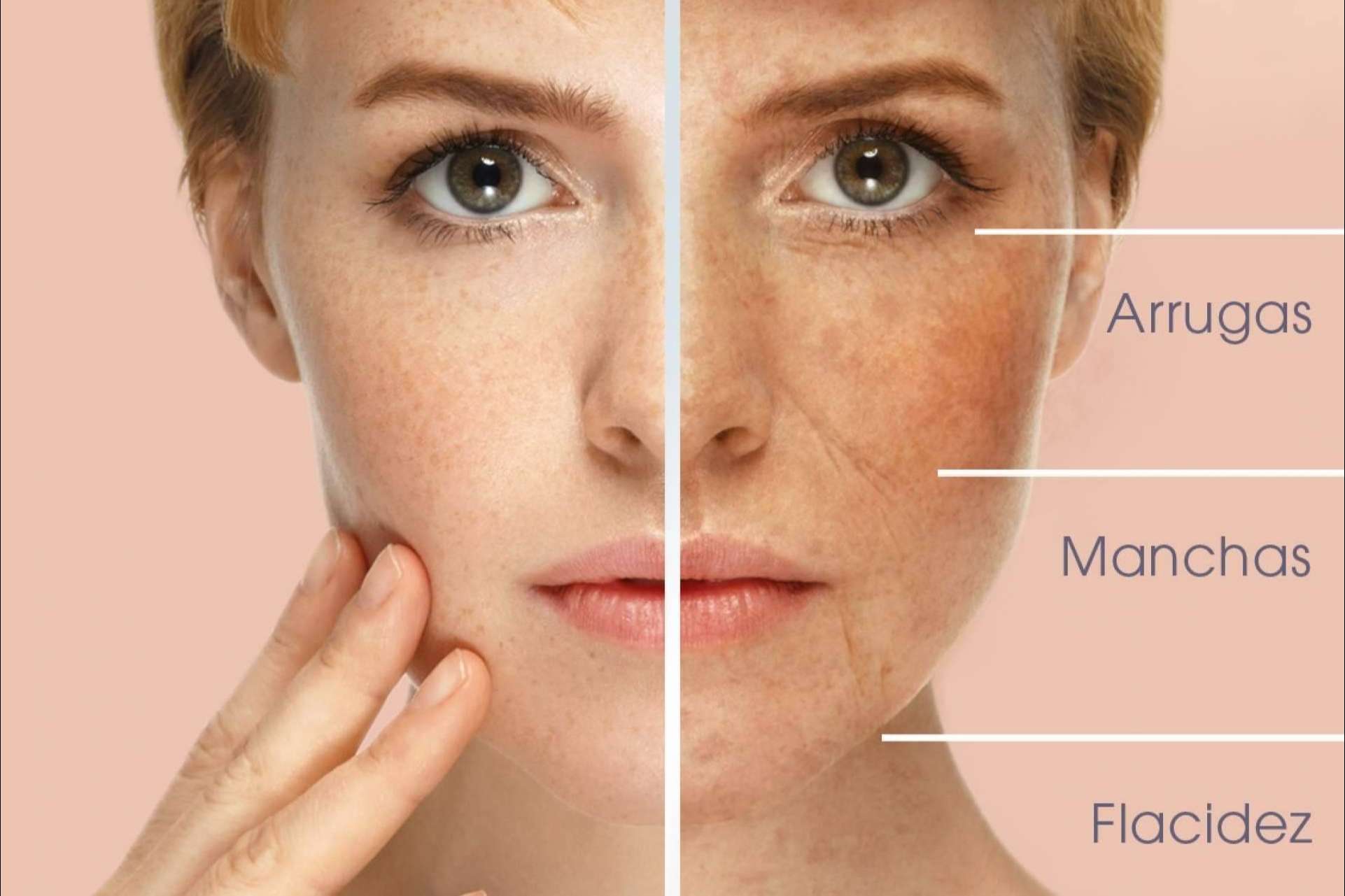 KōAN Club lleva a cabo el PRP facial para combatir los signos de envejecimiento