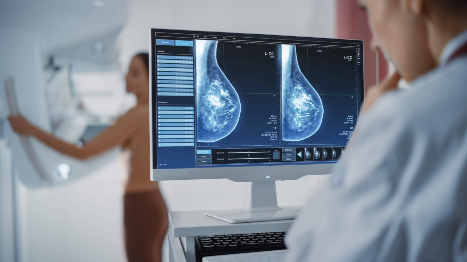 ¿Para qué sirve la genotipia y la oncología de precisión?