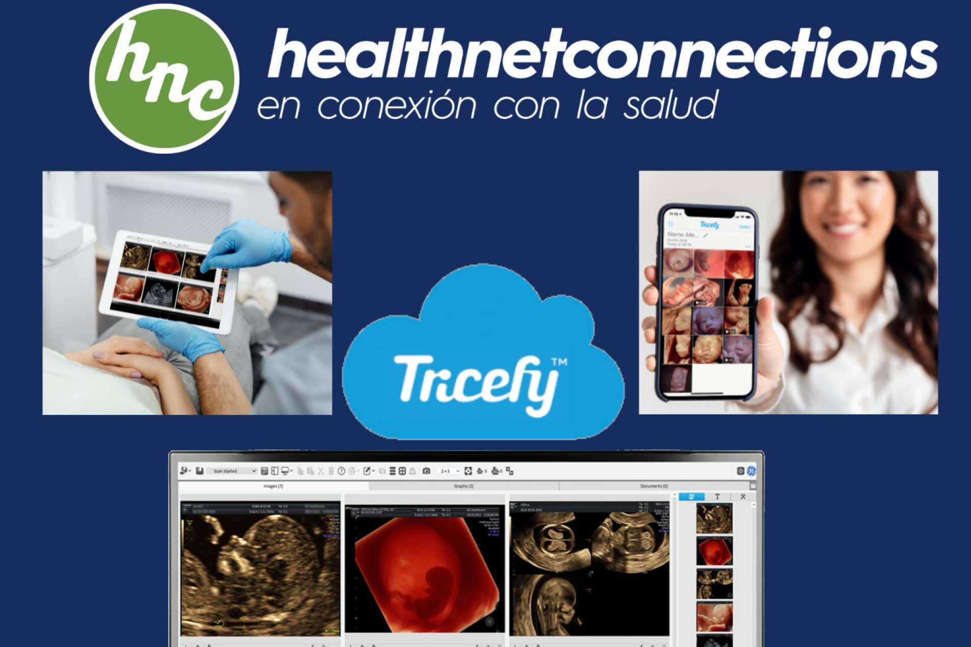 Tricefy permite disminuir el gasto económico de la consulta y respetar el medioambiente