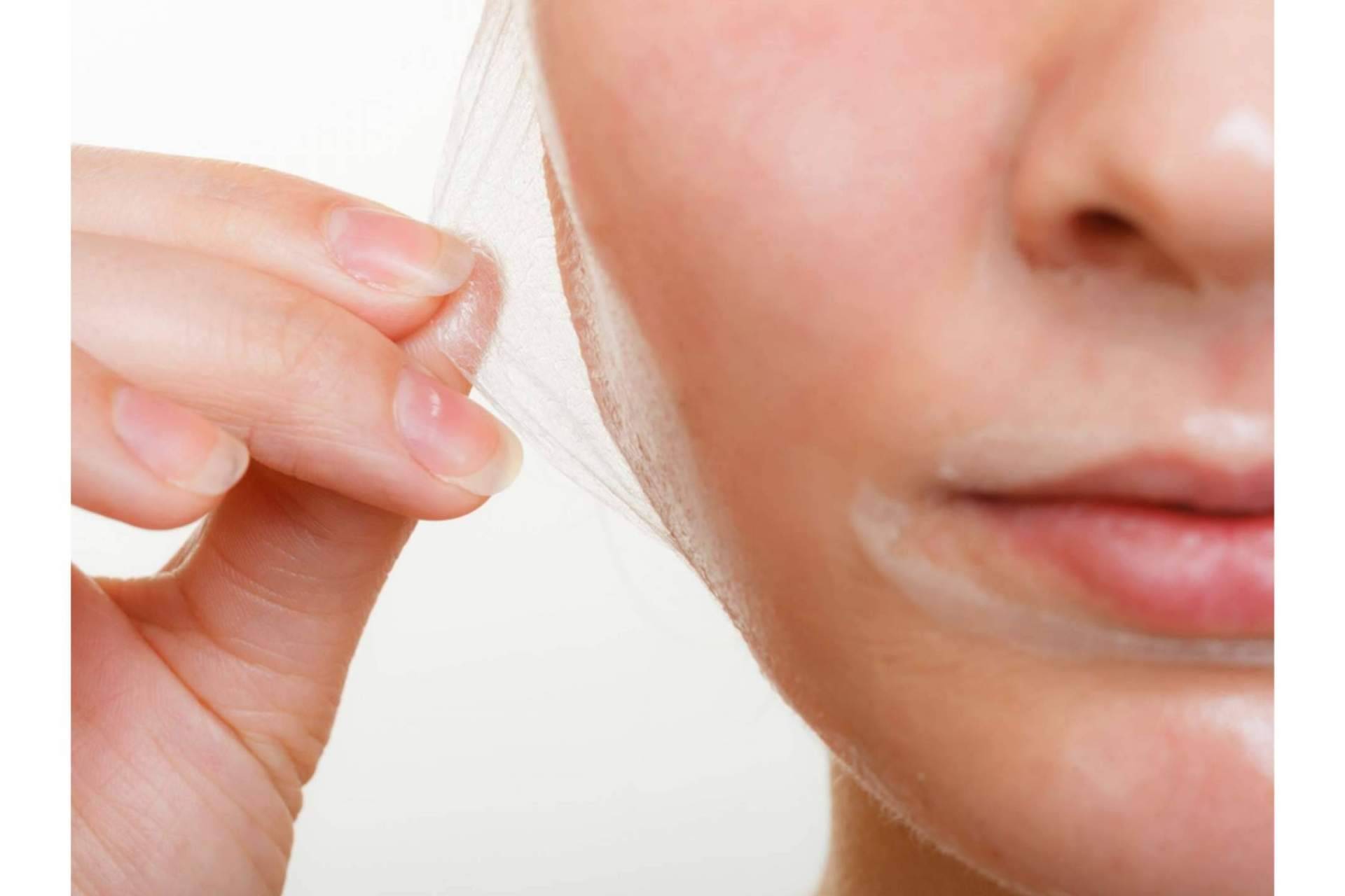 Crina Rus Beauty Center lleva a cabo peeling químico en diferentes partes del cuerpo