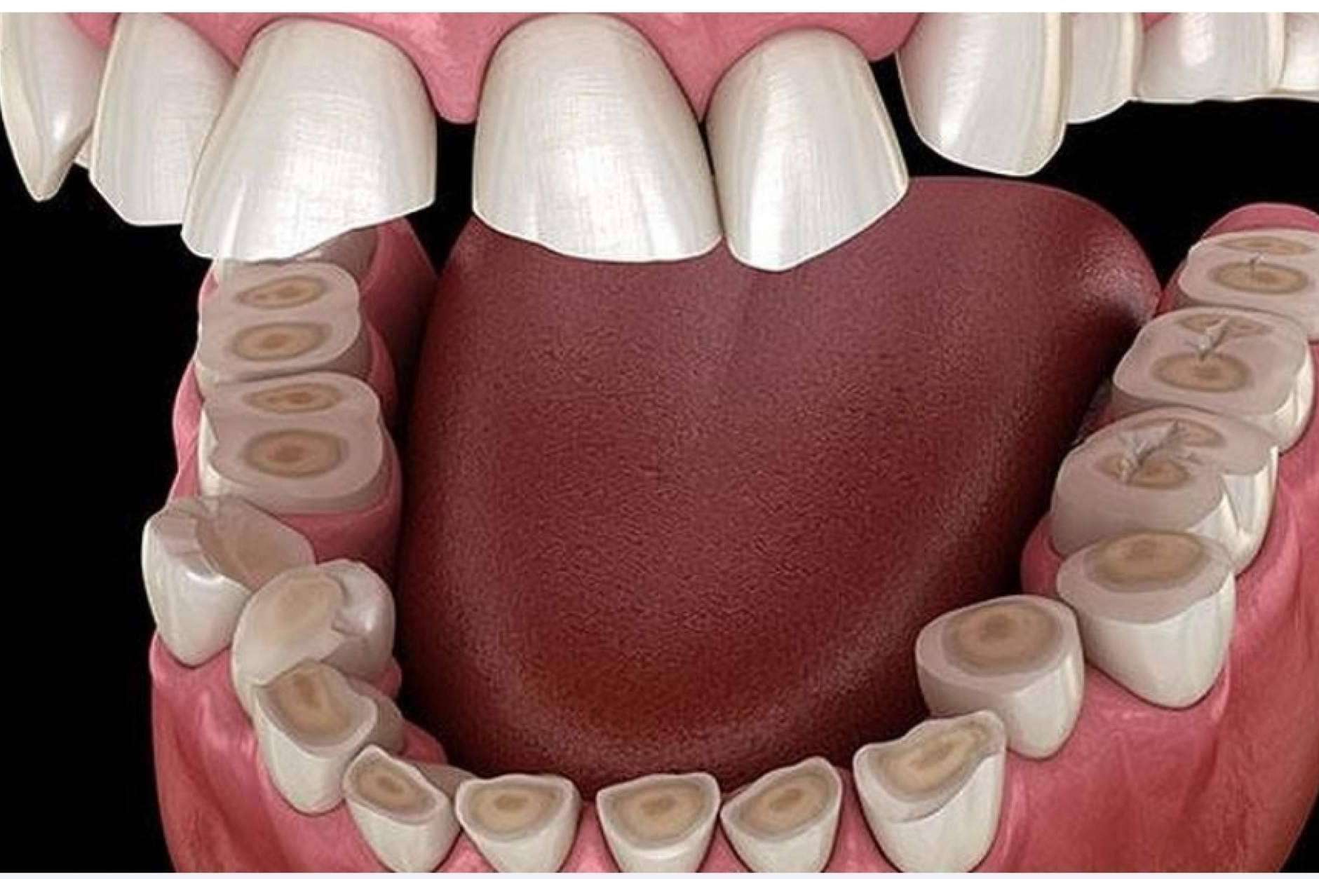 Dentinova explica cómo se previene el sangrado de encías