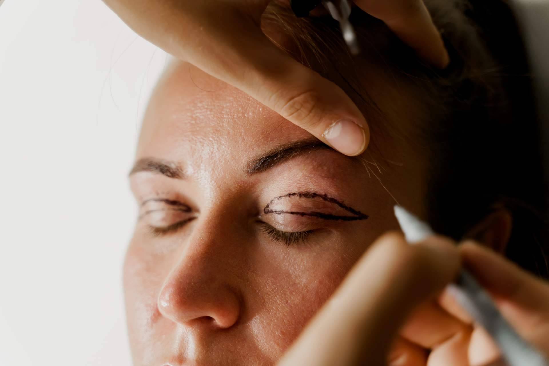 La Clinica de Medicina Estética Elegansse se consolida como uno de los referentes de blefaroplastia mínimamente invasiva de Barcelona