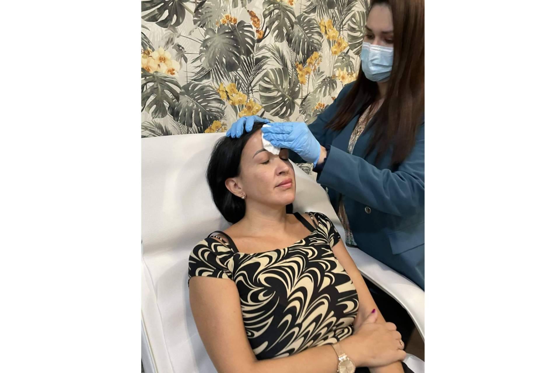 ¿Qué es y qué beneficios tiene el peeling químico para la piel?, con Cecilia Arthur