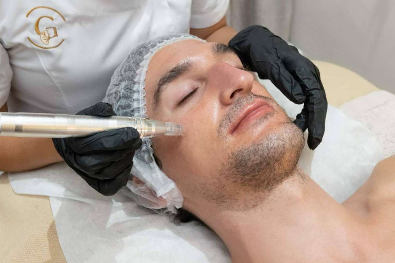 Realizarse un tratamiento innovador Dermapen Madrid en G&G Beauty