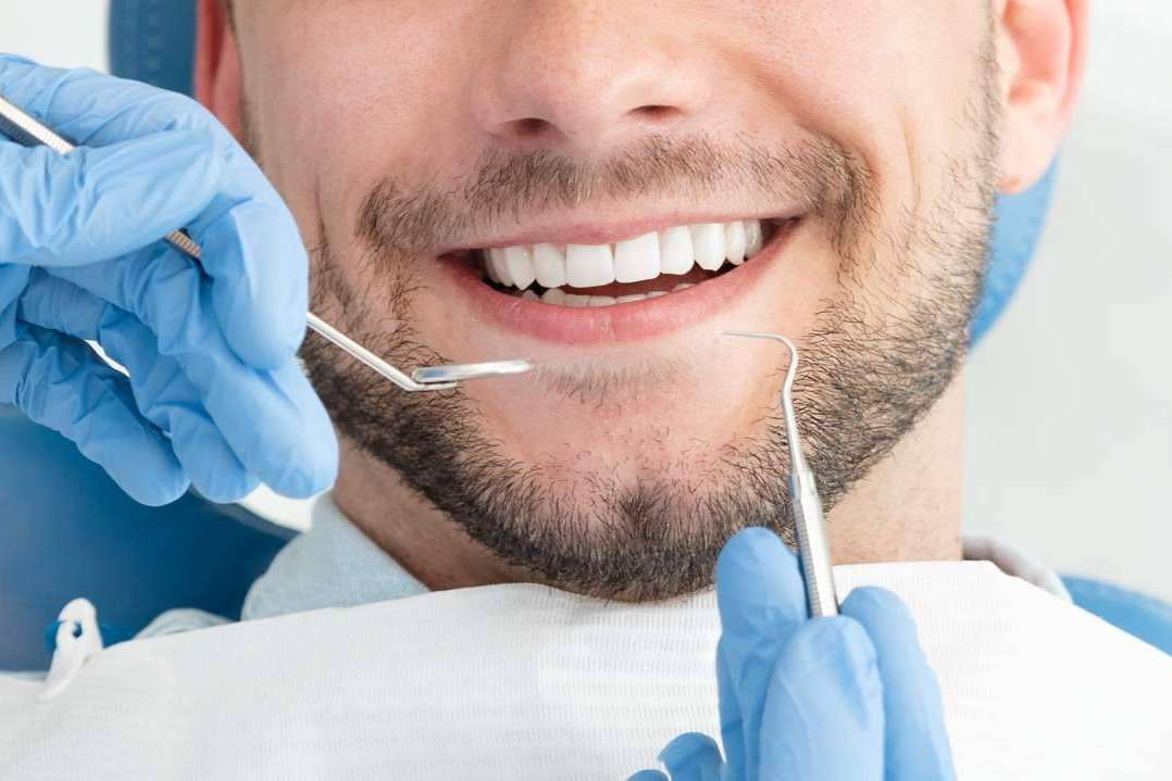 ¿Qué soluciones ofrecen las carillas dentales?