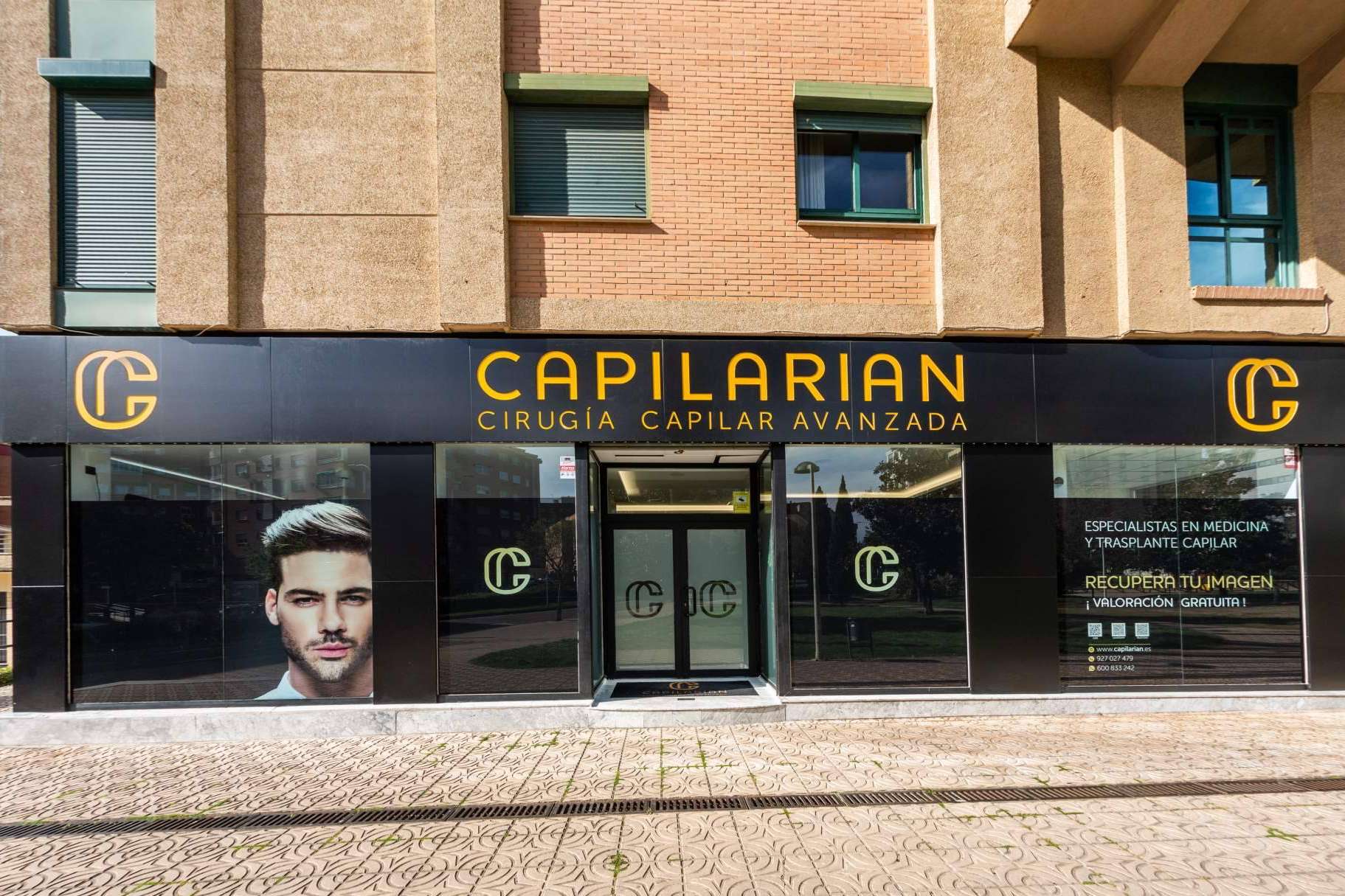 Recuperar el pelo con el propio cabello en la clínica Capilarian
