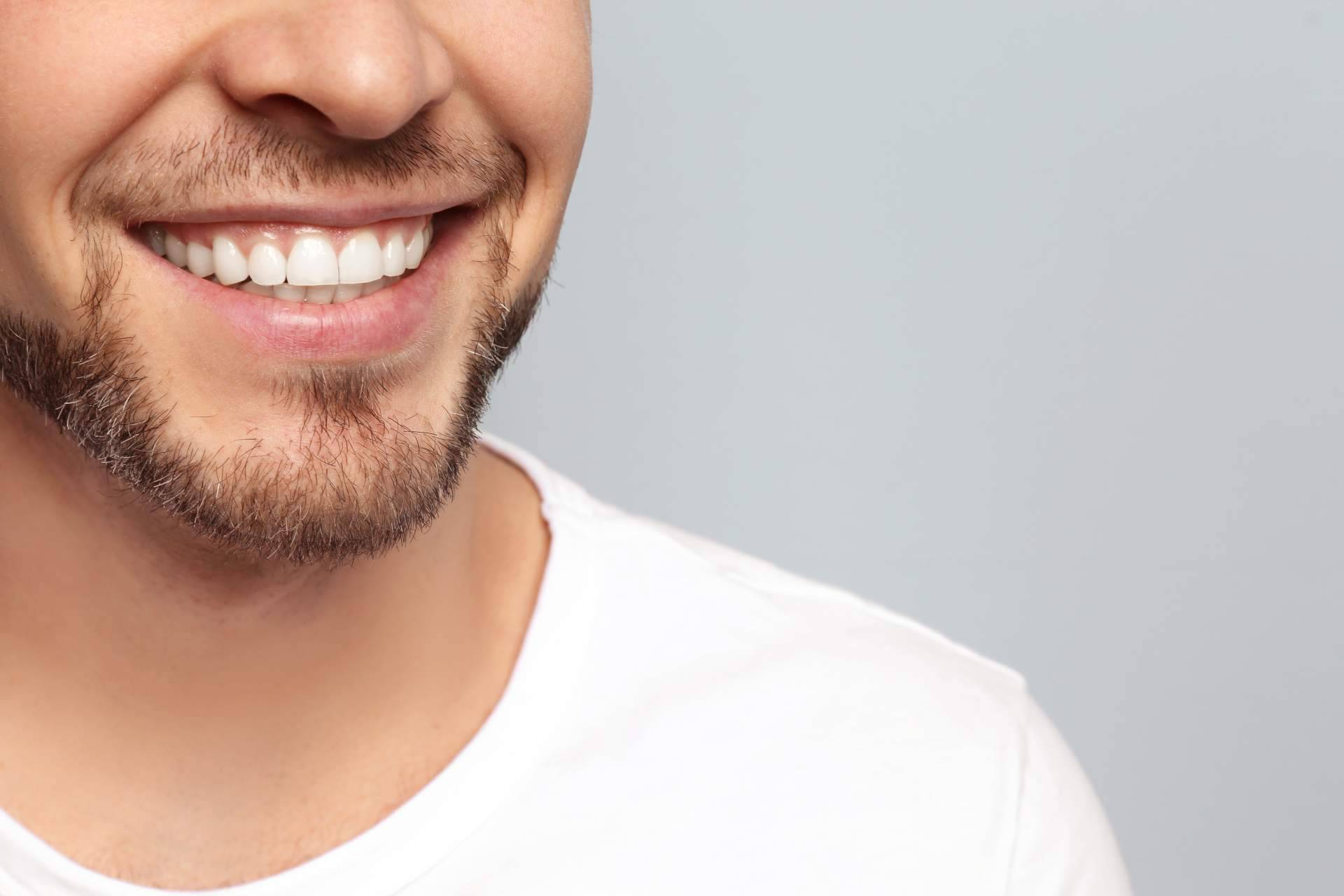 Carlos Saiz Smile es una clínica experta en la aplicación de carillas dentales