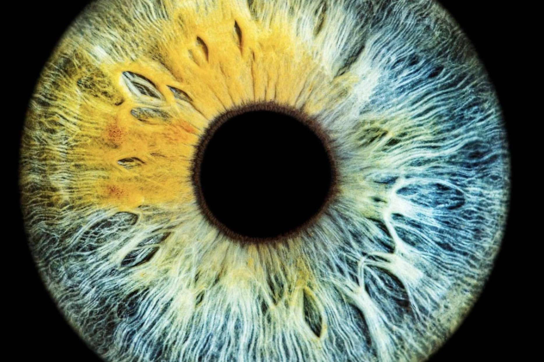 Nueva técnica fotográfica de alta definición del iris, con Eyecos