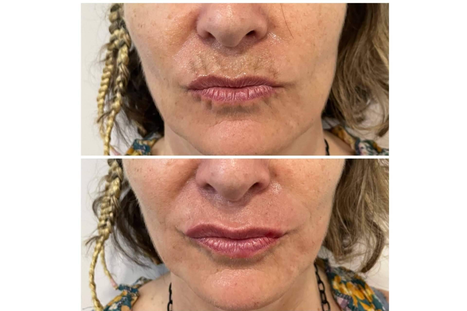 Cecilia Arthur, la clínica estética especializada en blanching