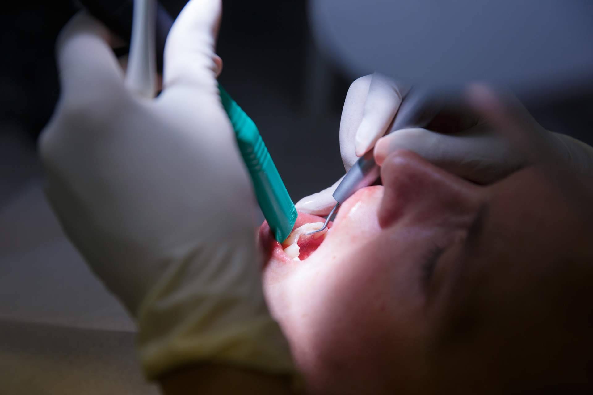 Clínica Dental Agudo Rosa explica cómo tratar la enfermedad de las encías