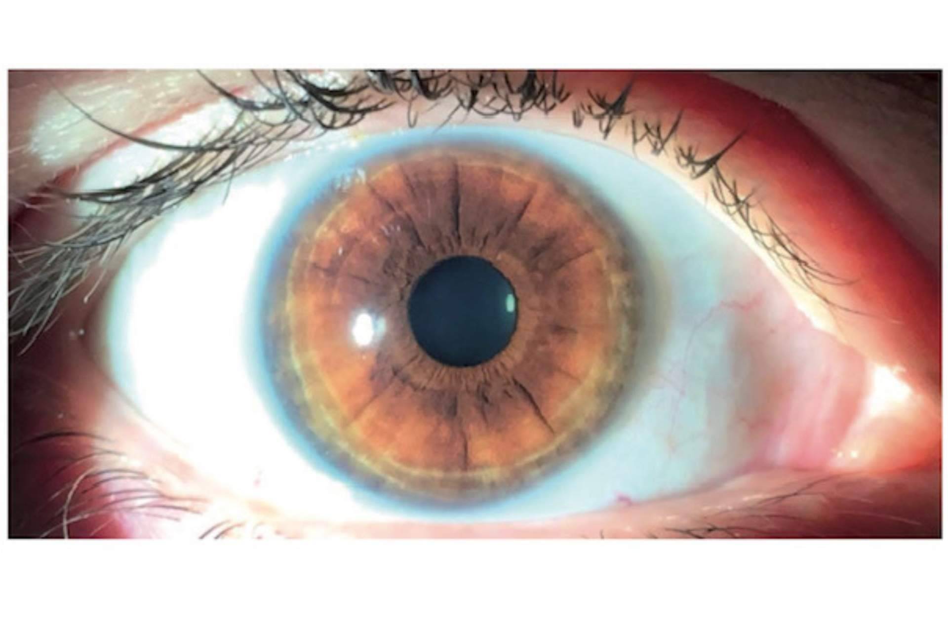 Los productos crece pestañas pueden oscurecer los ojos, por Clínica Eyecos