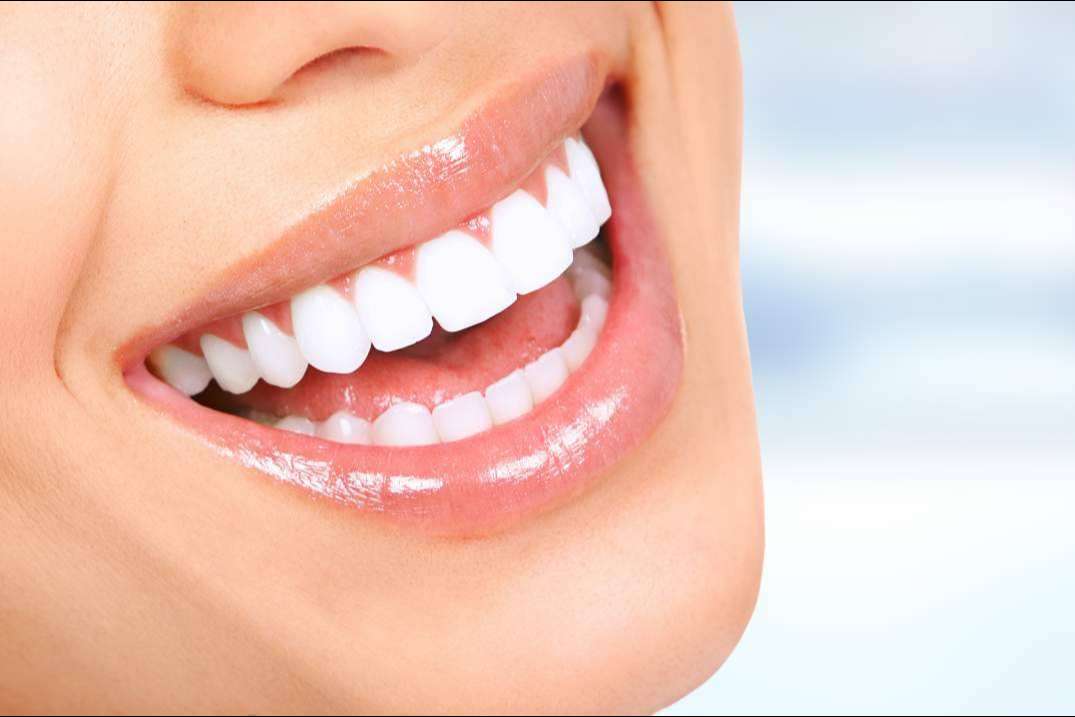 ¿En qué consiste la cirugía de sonrisa gingival?