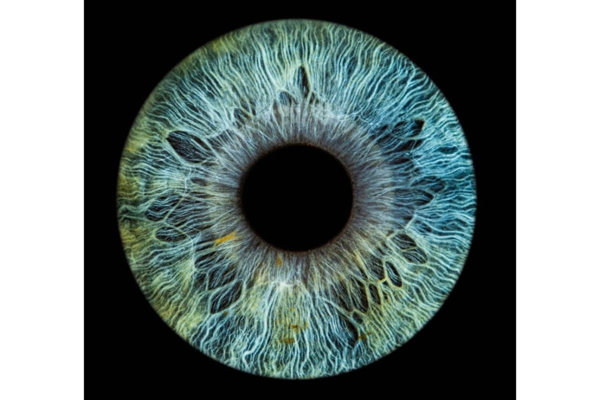 Celebridades con heterocromía ocular, de la mano de Clínica Eyecos