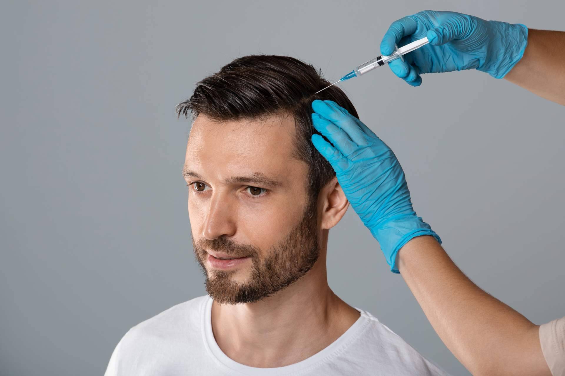Los tratamientos de mesoterapia son una opción muy recomendada para las personas que sufren alopecia según el doctor Jesus Mora