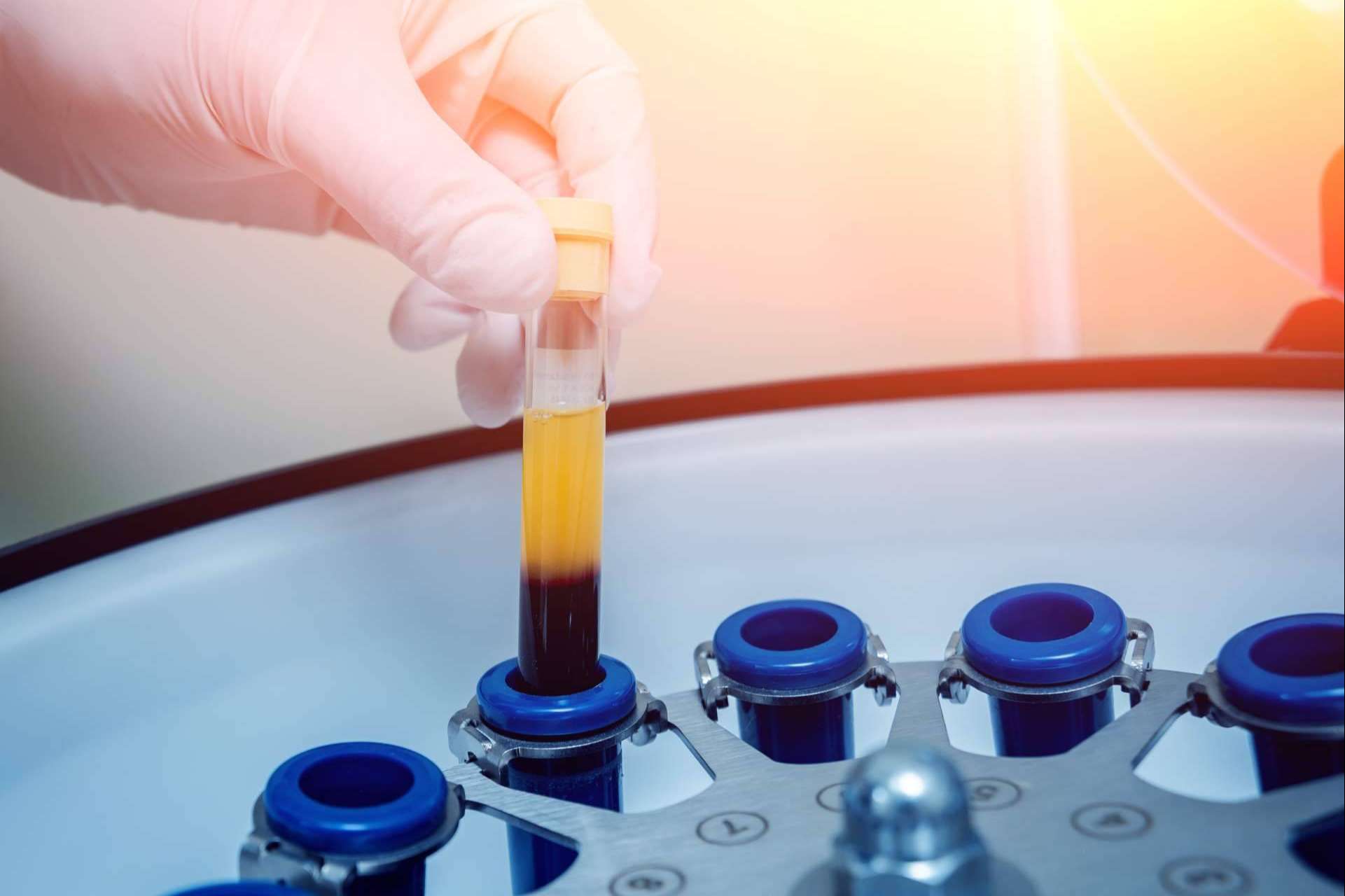 ¿Dónde obtener formación online en medicina regenerativa? Campus de Medicina