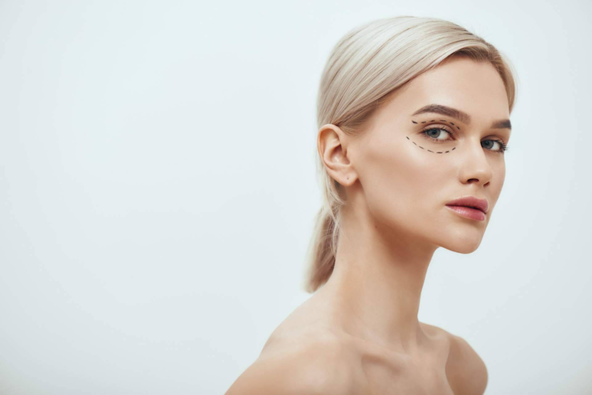 Blefaroplastia no quirúrgica ayuda a tratar párpados superiores e inferiores cuando existe piel redundante