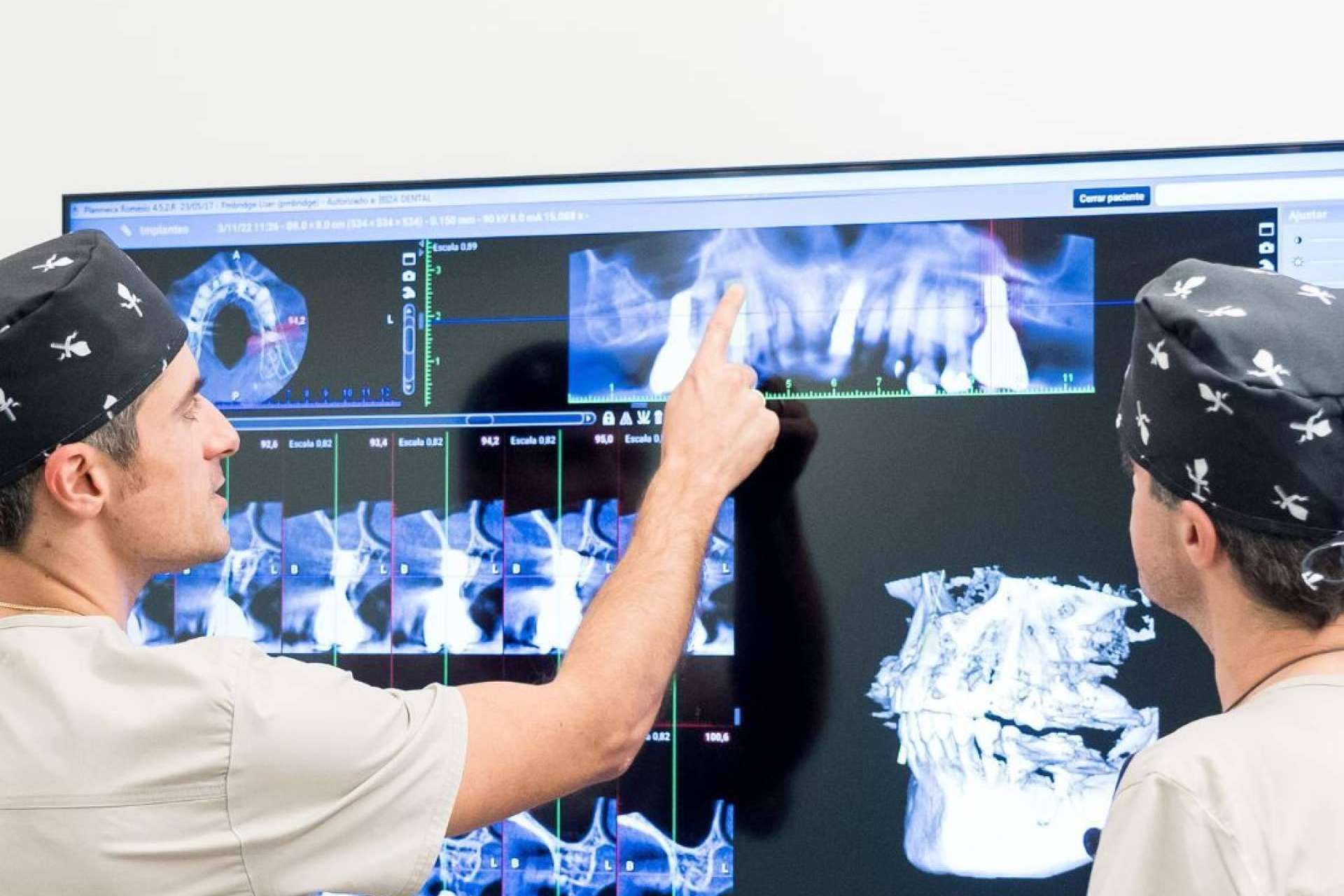 Los implantes All on 4, una innovadora técnica de restauración dental