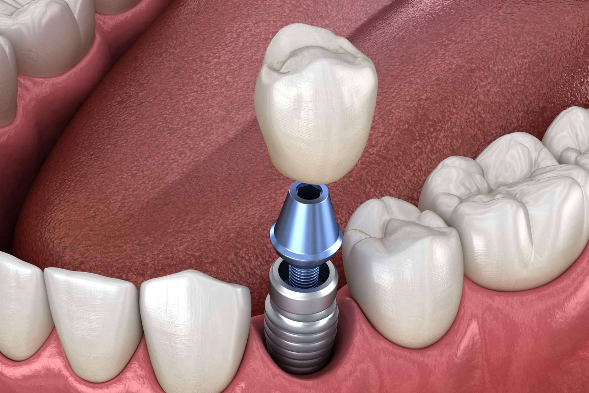 La amplia oferta de servicios odontológicos que pone a disposición la Clínica Dental Arai