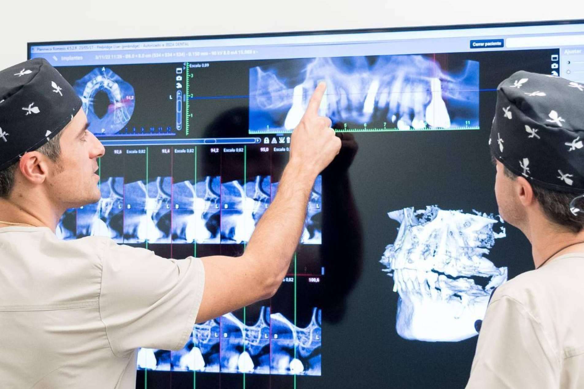 La innovadora técnica de injerto de encías; restaurando salud y estética dental con precisión