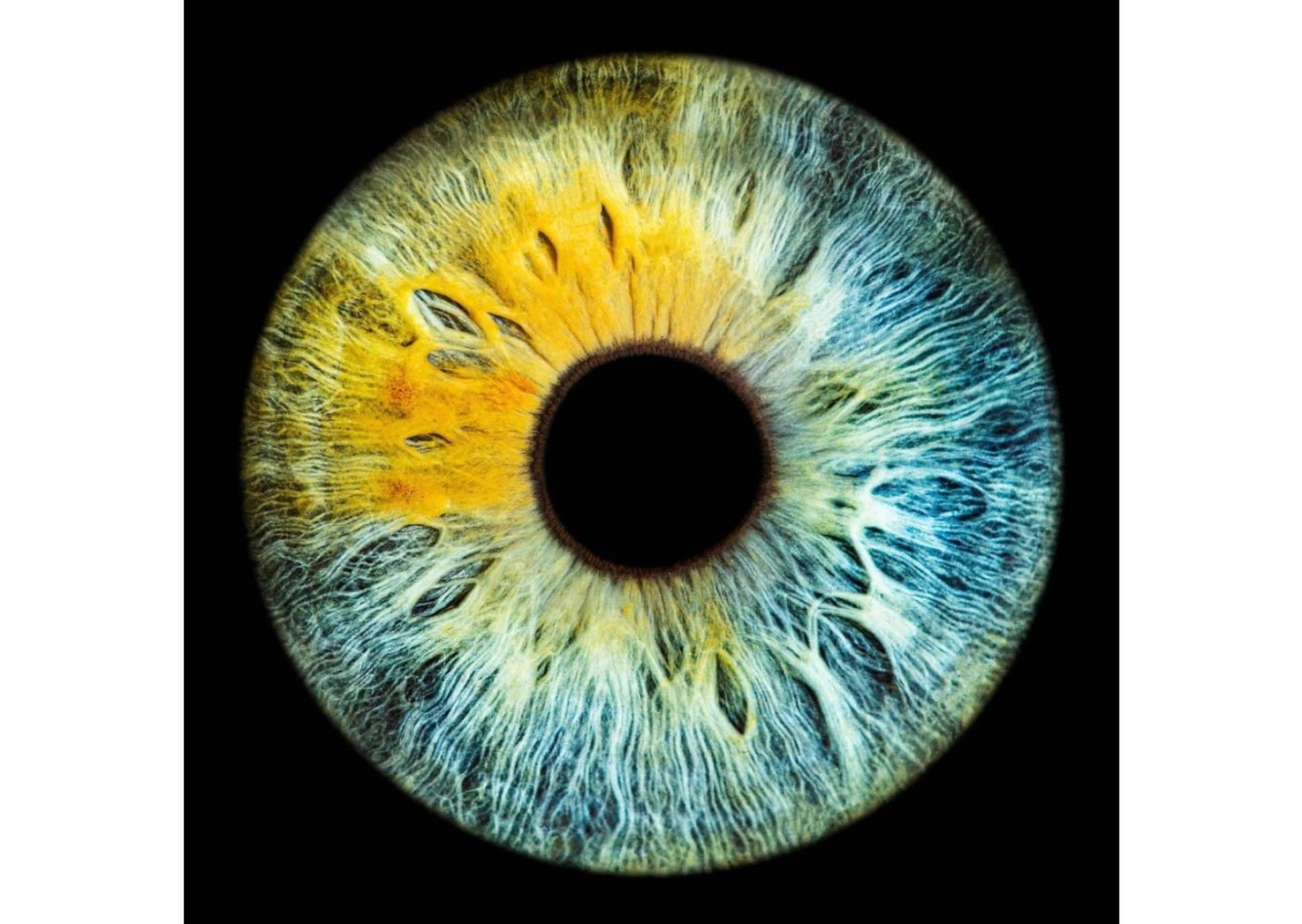 Las enfermedades metabólicas pueden cambiar el color de los ojos, una advertencia de la clínica Eyecos