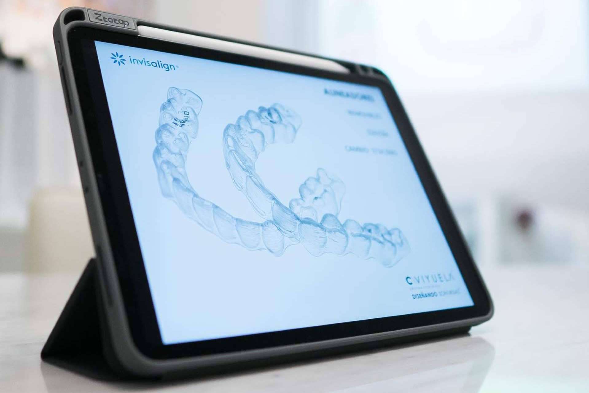 ¿Cuál es el precio de Invisalign? Toda la información acerca de los precios de la ortodoncia invisible más buscada