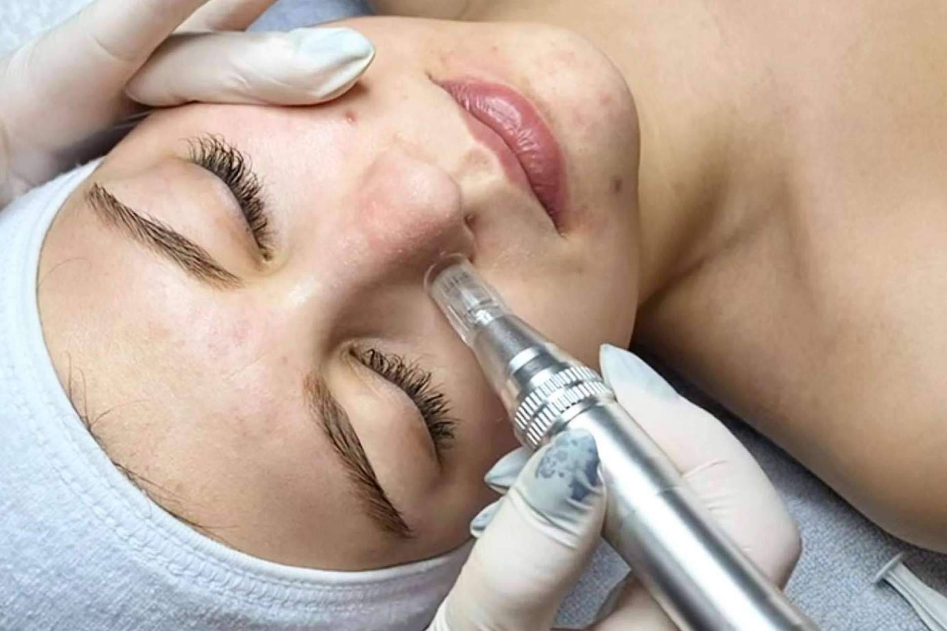 Cynthia Micro & Beauty, un centro de estética profesional en Terrassa y Madrid