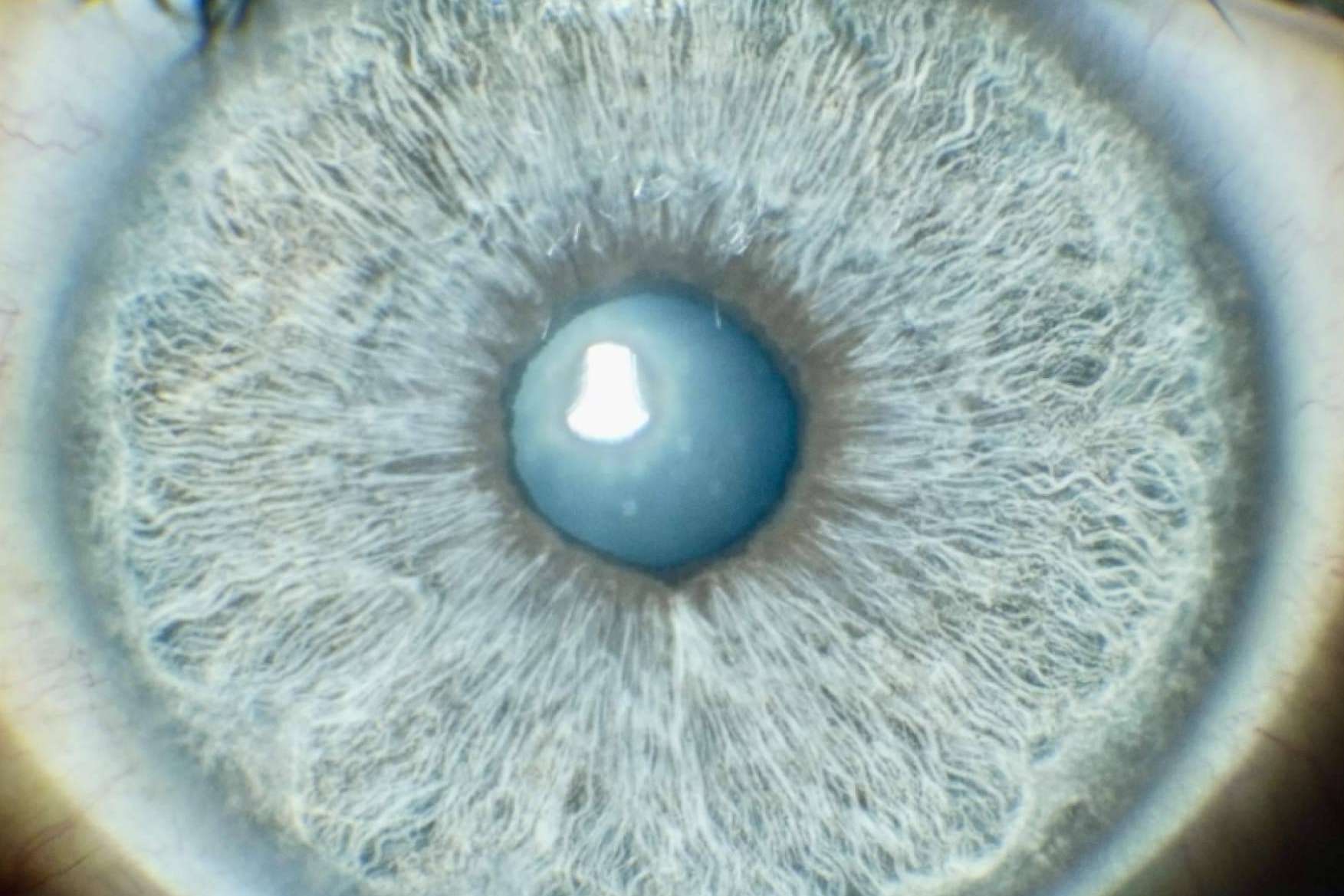 ¿Por qué la gente quiere cambiarse el color de los ojos con láser?, por Eyecos
