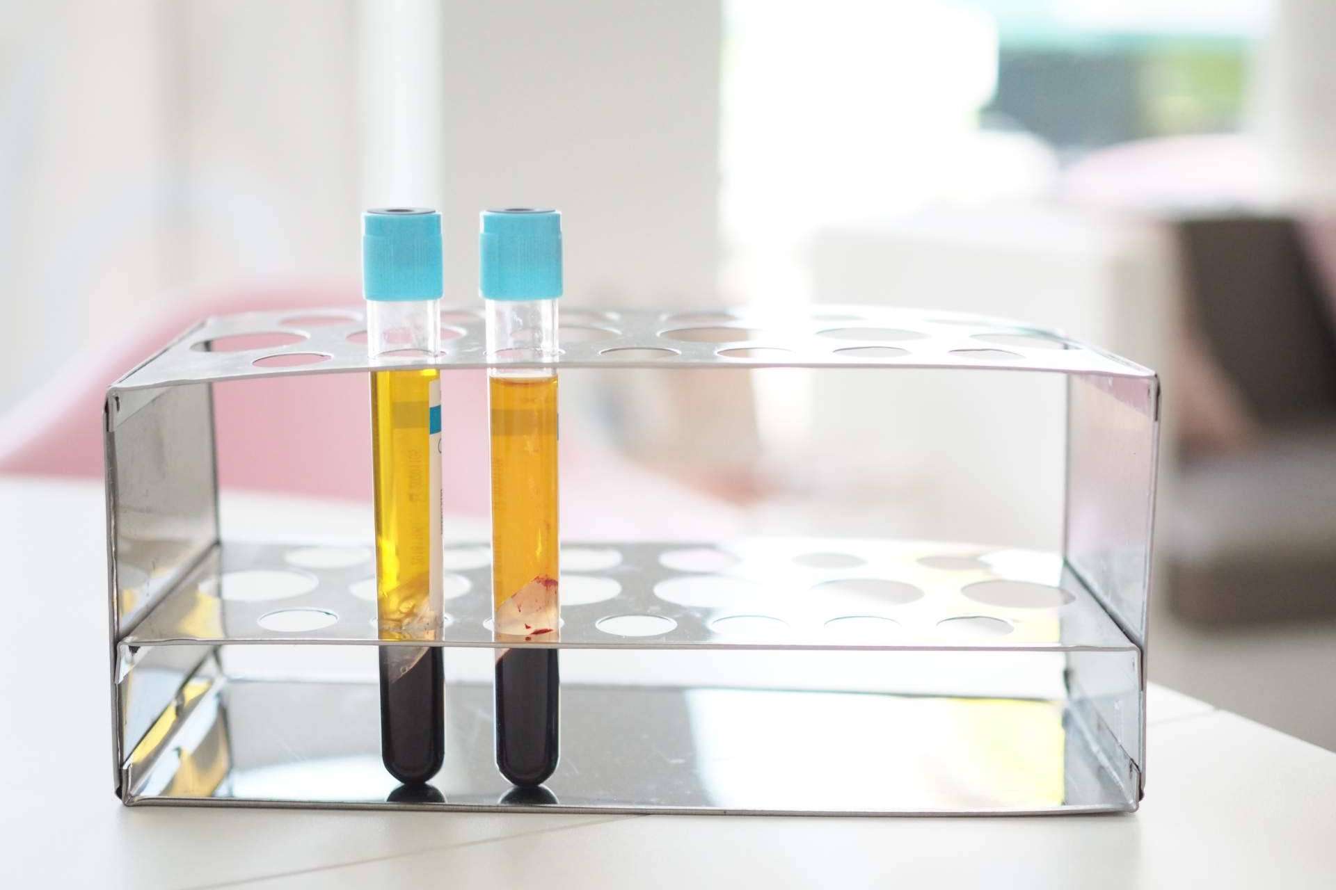 El innovador tratamiento de plasma rico en plaquetas de Centro Estética El Pilar