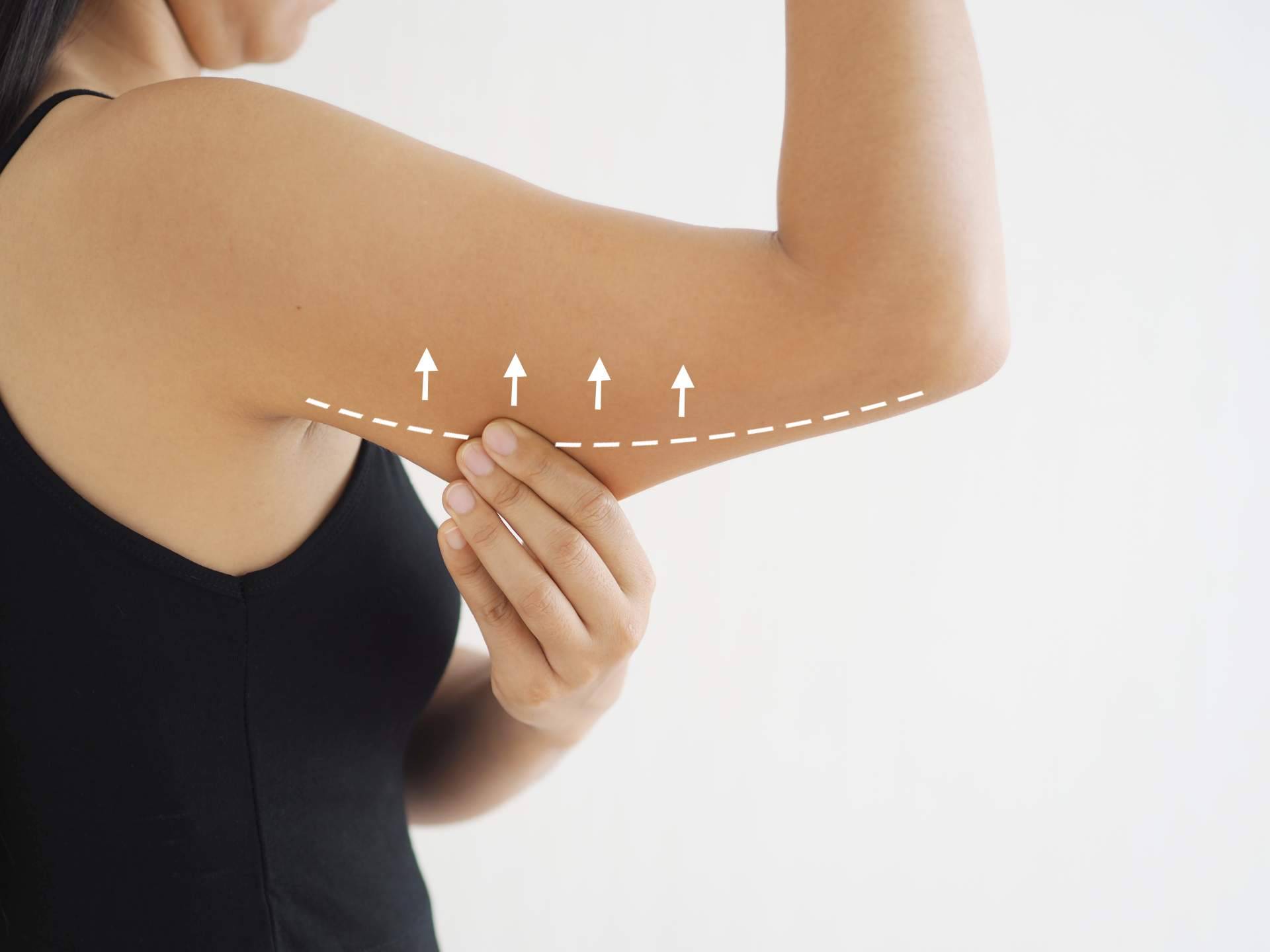 Tratamientos anticelulíticos saludables con Cuerpo Libre