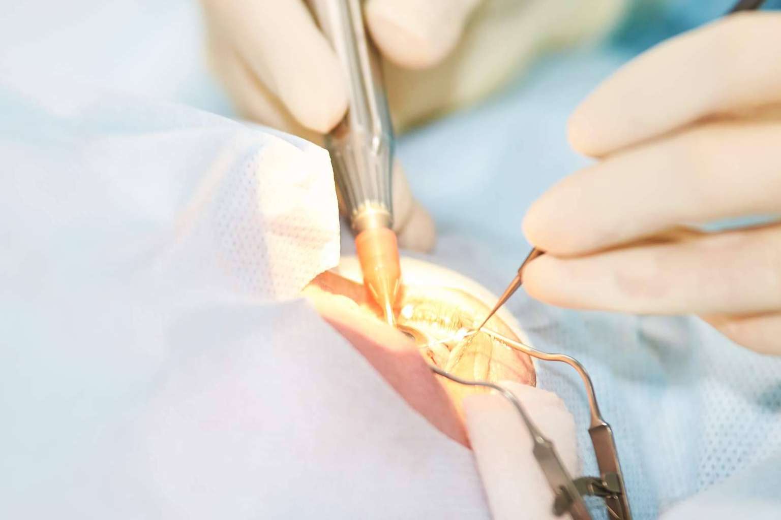 Realizarse una cirugía refractiva de la mano del Departamento de Oftalmología del Hospital Universitari Dexeus