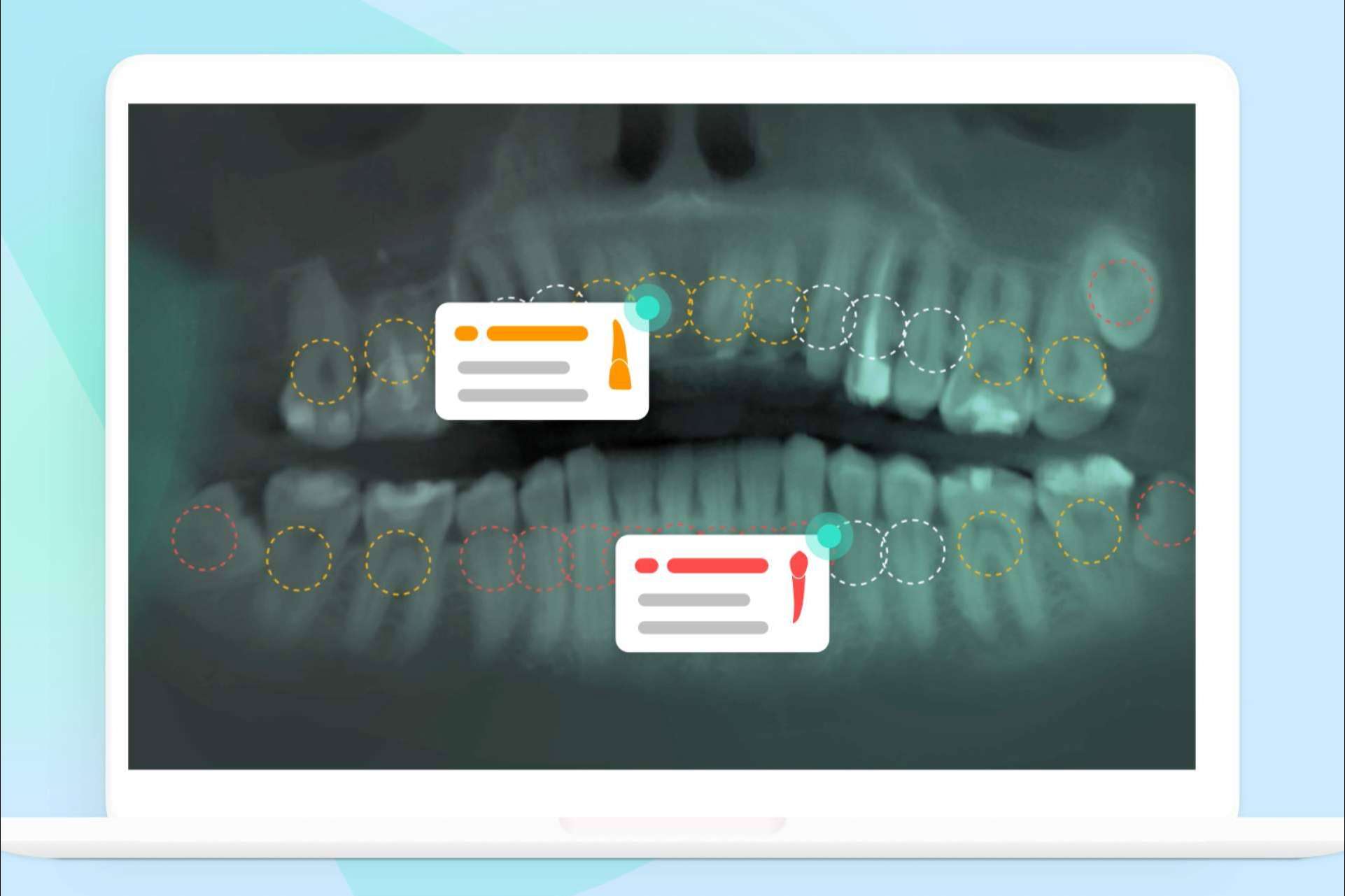 Dentomo, el diagnóstico potenciado por inteligencia artificial que revoluciona la práctica odontológica