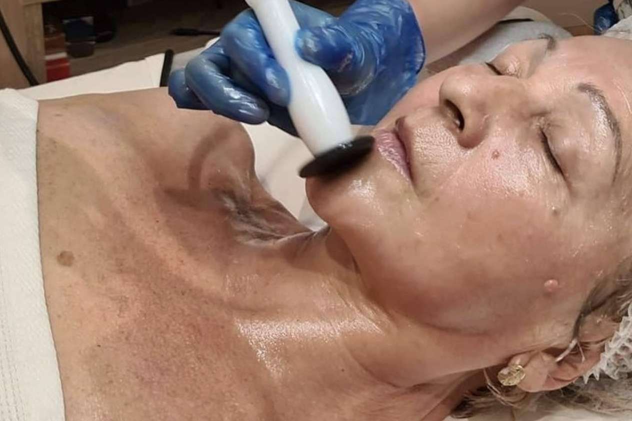 Crina Rus Beauty Center destaca con su tratamiento de radiofrecuencia en Madrid