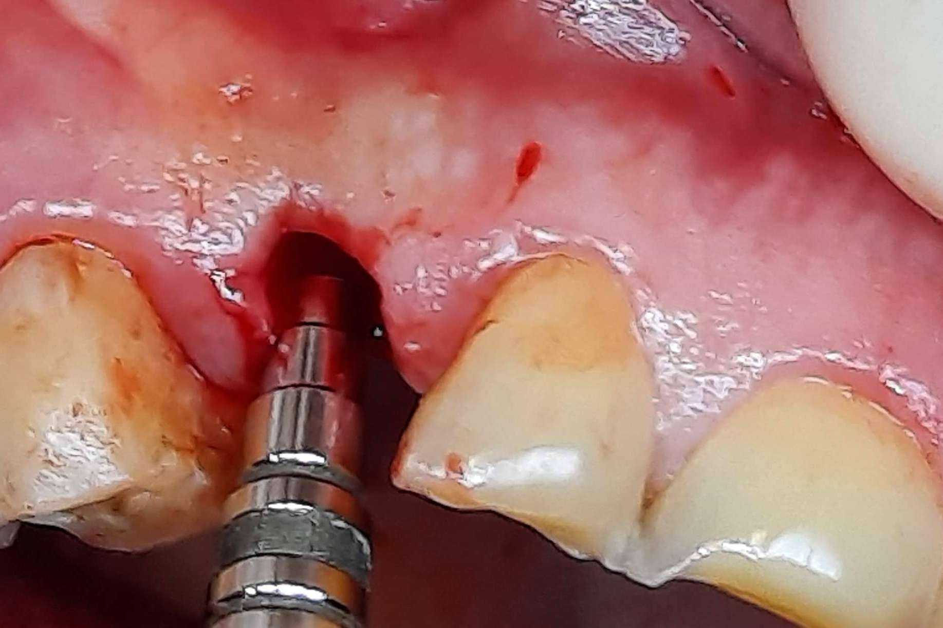 ¿Cuál es el poder de la sanación interna? Clínica Biorigenera