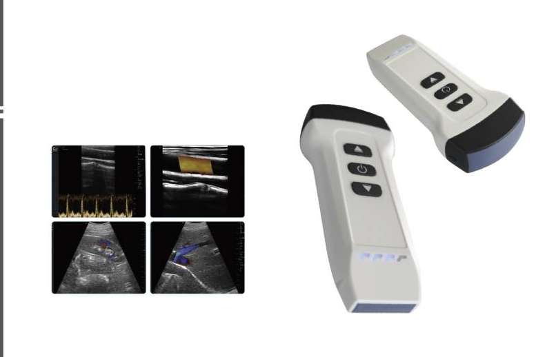 Diagnóstico avanzado con el ecógrafo portátil e inalámbrico de SCPmedical