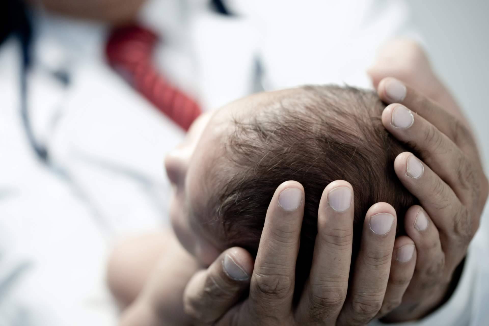 Hidrocele y hernias inguinales en bebés, ¿hay que operar?