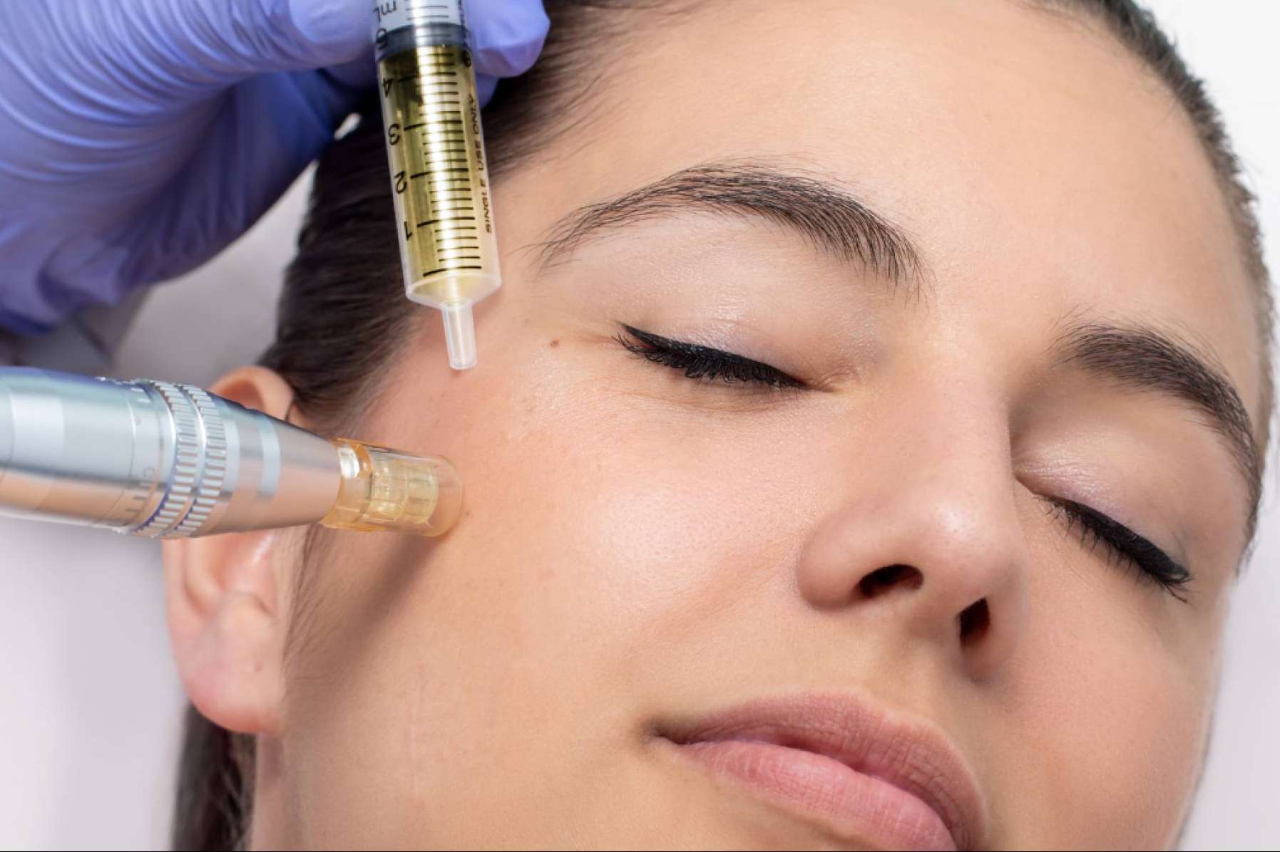 Soluciones naturales y sin bisturí para rejuvenecer el rostro en la clínica de la Dra. Cecilia Arthur