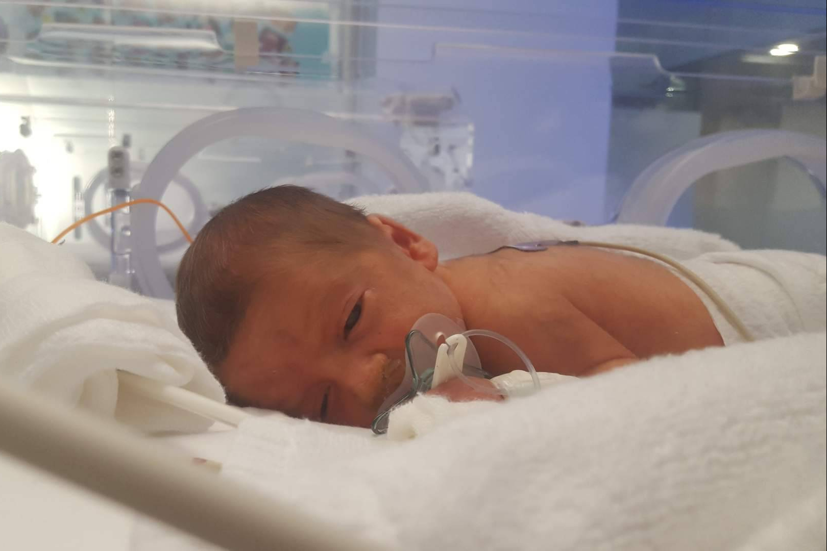 Día Mundial del Niño Prematuro; miles de familias españolas enfrentan retos que no se ven